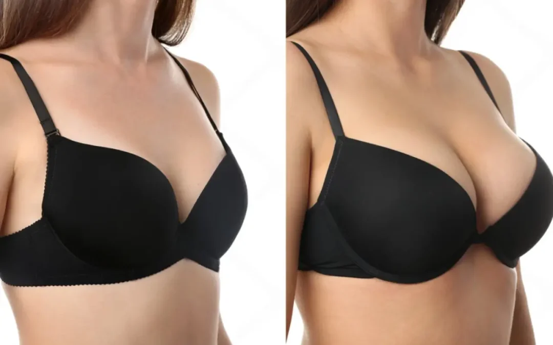 Cirugía plástica en Cantabria