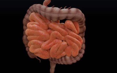 Tratamiento del Síndrome del intestino irritable en Torrelavega