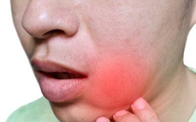 Tratamiento de lesiones en la boca en Santander, cuándo acudir al cirujano maxilofacial