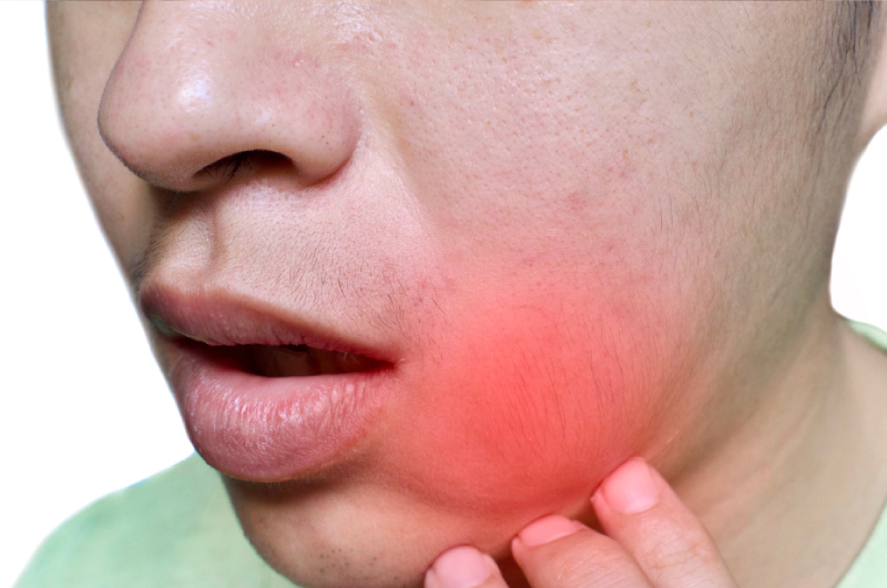 Tratamiento de lesiones en la boca en Santander, cuándo acudir al cirujano maxilofacial