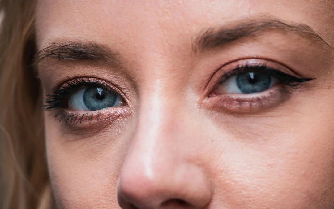 Lifting en Santander: qué es el lifting endoscópico y cuándo está indicado