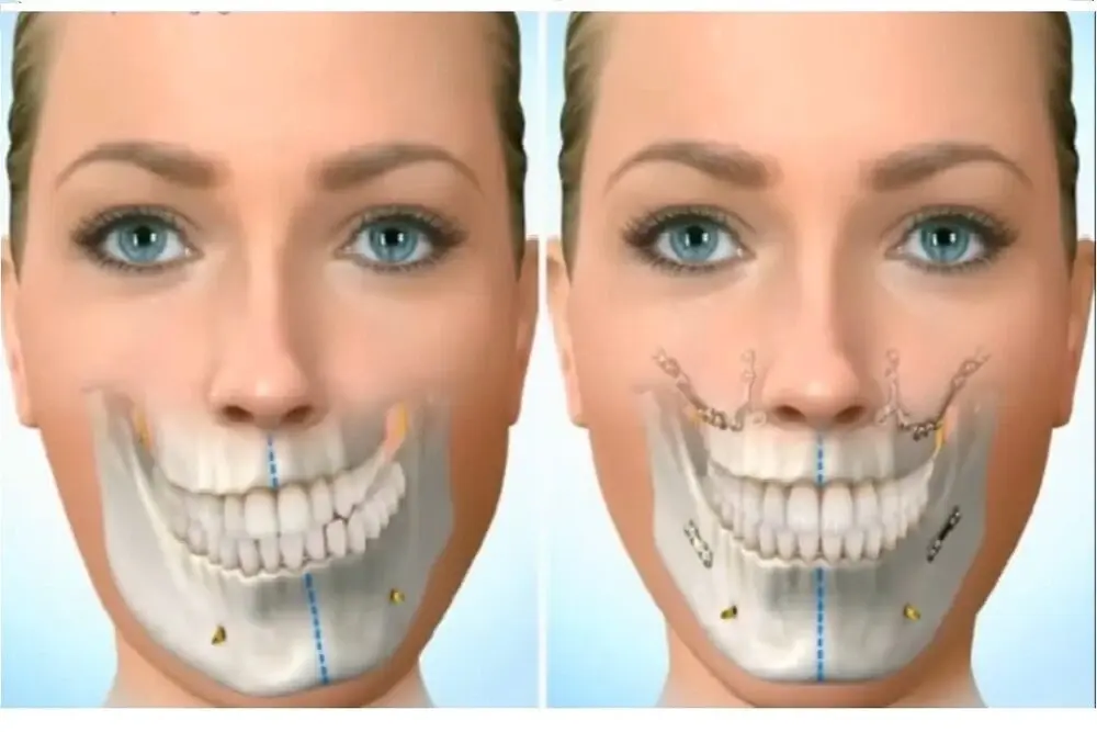 Diferencias entre cirugía maxilofacial en Santander, odontología y cirugía estética facial