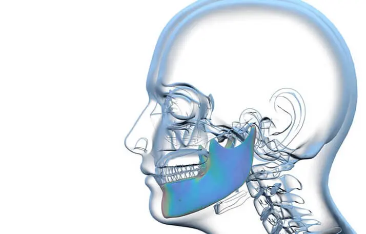 Problemas de la mandíbula que trata un cirujano maxilofacial en Santander