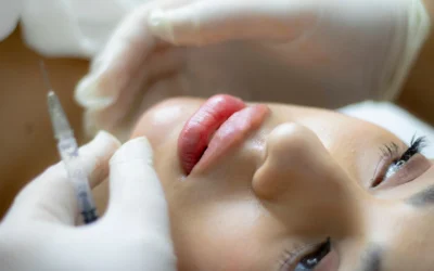 Rejuvenecimiento facial en Santander: todo lo que debes saber sobre el ácido poliláctico