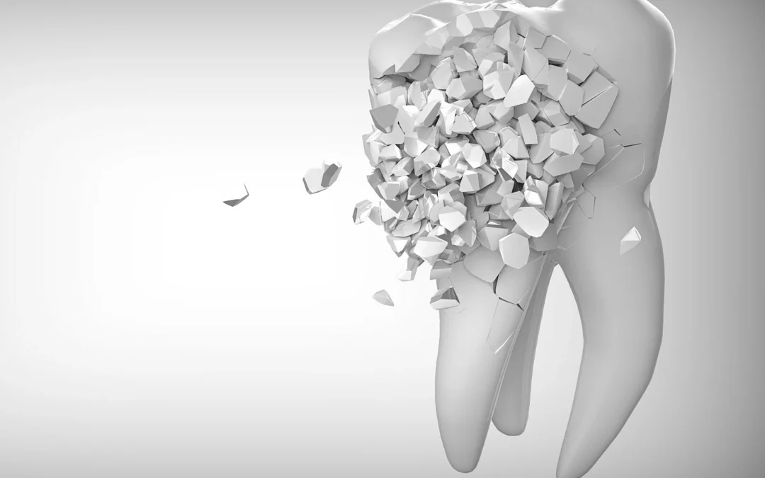 Implante dental en Torrelavega en casos complejos