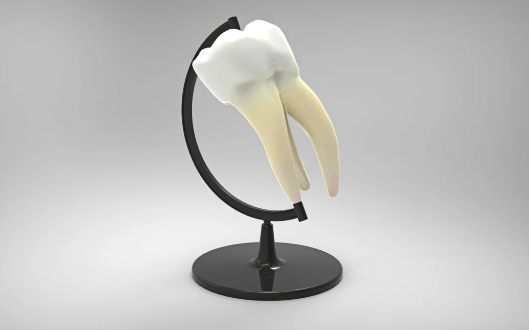 Implantes dentales en Torrelavega y cirugía maxilofacial