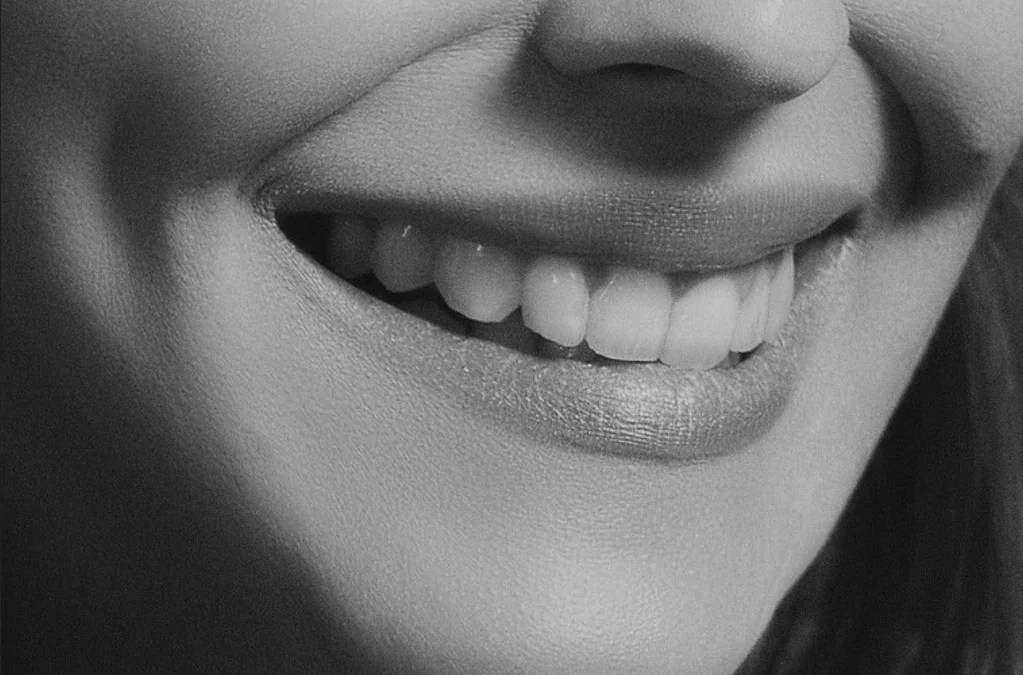Carillas dentales en Torrelavega
