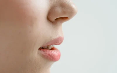 Rinoplastia en Santander: nariz desviada, asimetrías y corrección estética